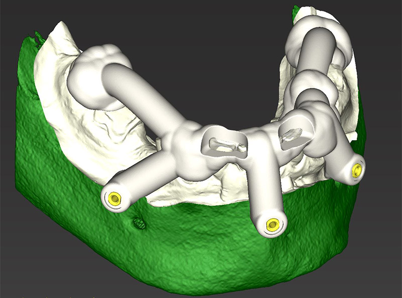 Fig-48