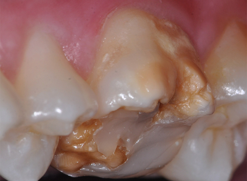 Photo-3