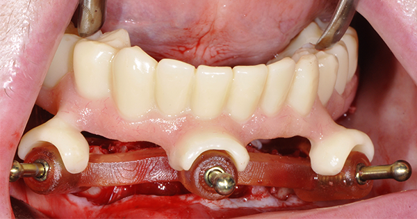 La naissance des dents - Dentalespace