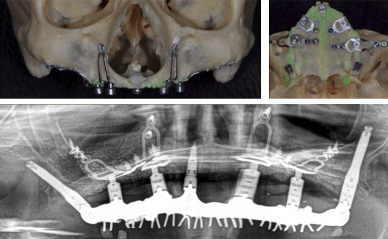 Fig.07