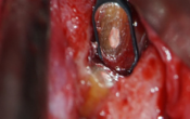 Vignette-Site-Formation-microchirurgie-Boublil.psd