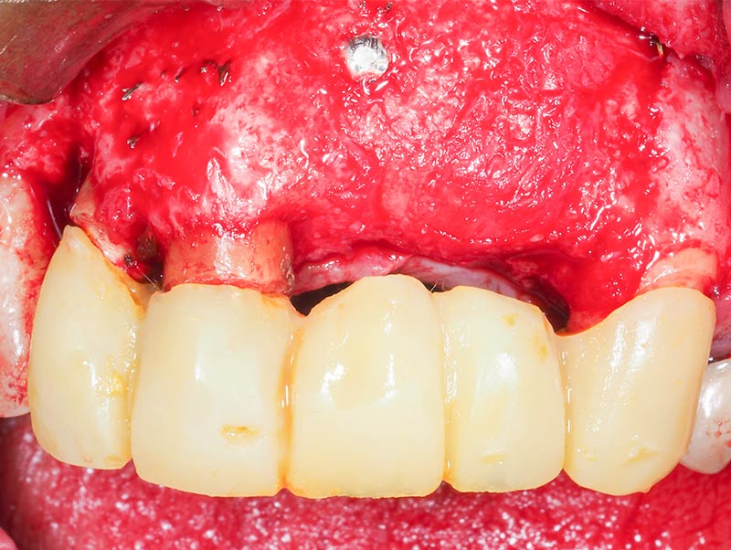 Guide-chirurgical-39