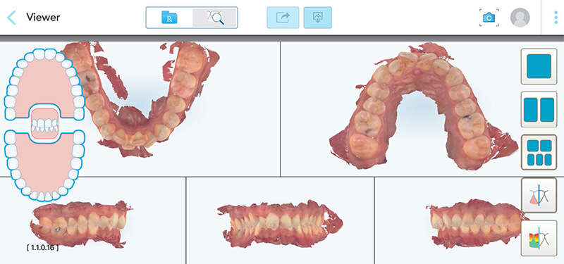 Article-alignement-Fig-2-Interface-ClinCheck