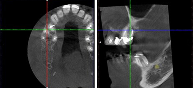 Radiologie-3D-Claude-Authelain