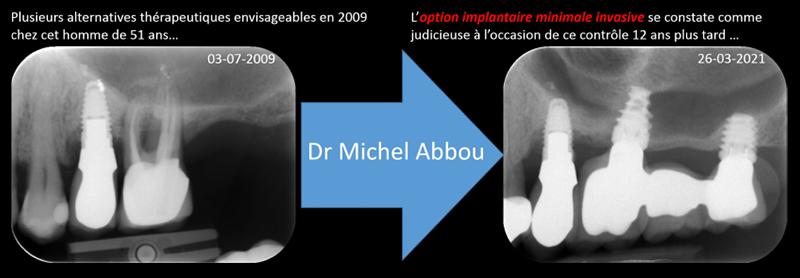 Figure-3-Minimale-Invasive-Attitude