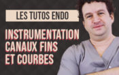 Vignette-Site-Video-1-Canaux-fins-et-courbes
