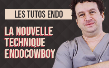 Vignette-Site-Video-2-Endocowboy