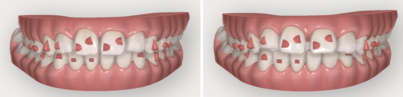 fig4b-4c