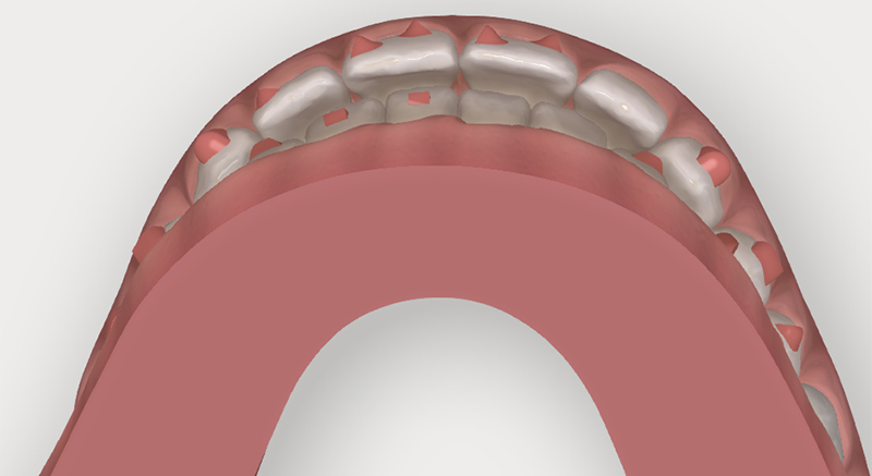 fig4d