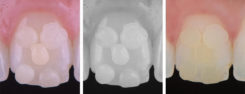 fig-06