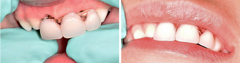 Cas clinique Marie Dacquin Solution CPP 3
