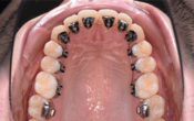 Vignette-Site-orthodontie-sur-mesure-Ons-Alouini