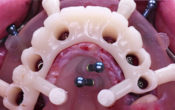 Vignette-Site-Video-BOI-Popelut