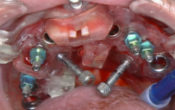 vignette-jonathan-amar-chirurgie-guidee