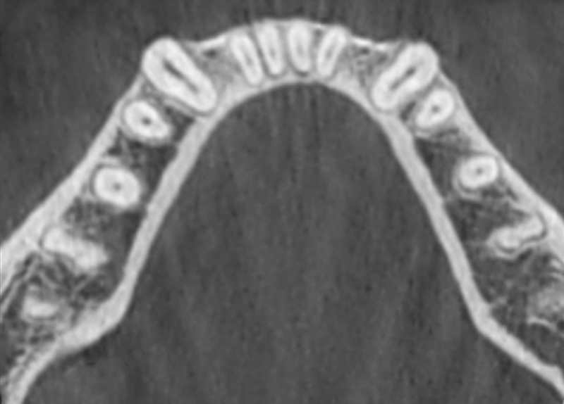 fig07-cortico