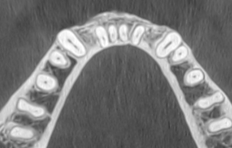 fig09-cortico