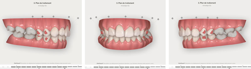 Situtation-Initiale-Capture-2-pre-composites