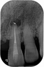 fig-09-endo-guides