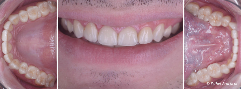fig-19