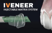 vignette-CP-Iveneer