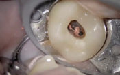 Vignette-Site-Video-Thermafil-Boublil-04-2023