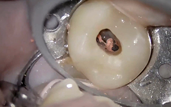 Vignette-Site-Video-Thermafil-Boublil-04-2023