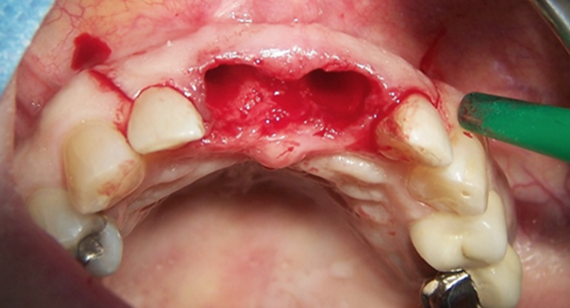 fig-04-article-Jonathan-Amar-extraction