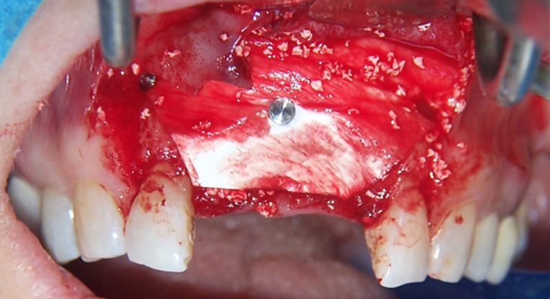 fig-07-article-Jonathan-Amar-extraction