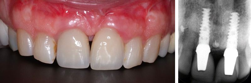fig-16-article-Jonathan-Amar-extraction