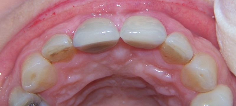 fig-17-article-Jonathan-Amar-extraction