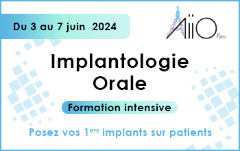 Vignette-Formation-intensive-implantologie-orale-AIIO