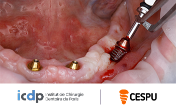 ICDP - CESPU
