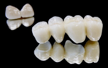 Emax zircone