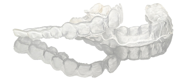 Eclaircissement dentaire, Gouttières imprimées