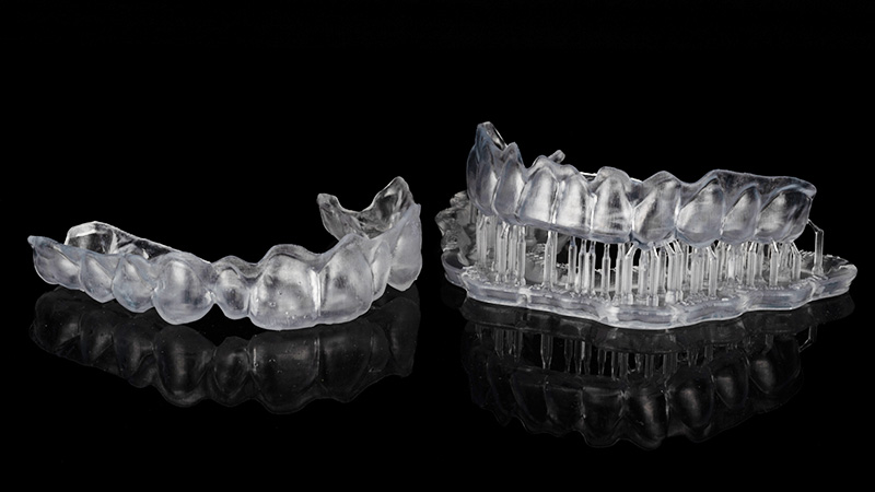Eclaircissement dentaire, gouttière