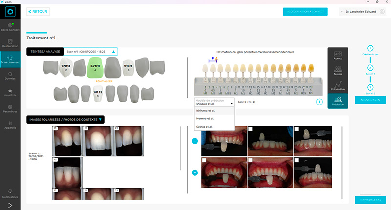 Interface du module éclaircissement avec choix des prédictions