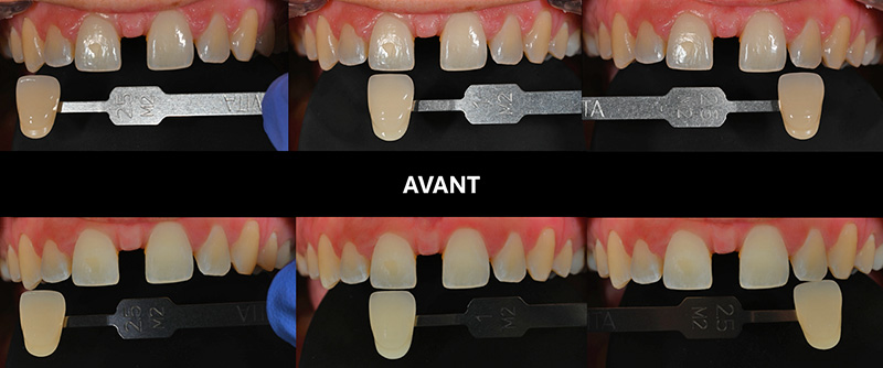Photos de la teinte initiale en lumière naturelle et polarisée