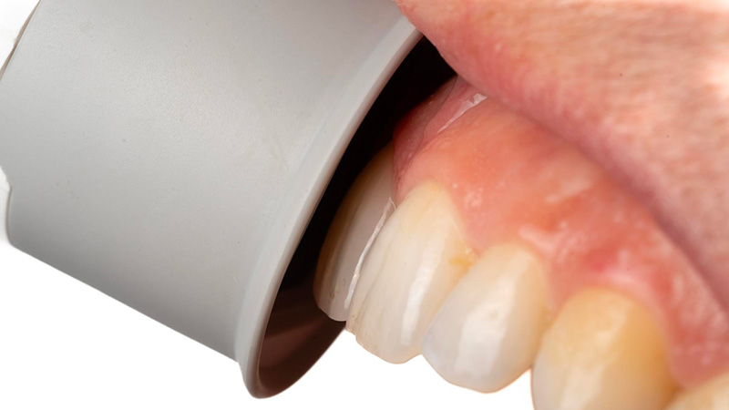 Relevé de la couleur à l’aide du spectrophotomètre