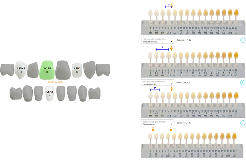 Résultats dent par dent et comparaison aux prédictions