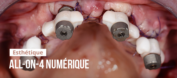 Slider-Article-IPD-Le-flux-numerique_V3