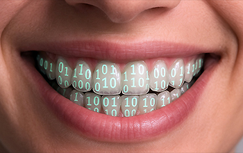 Eclaircissement dentaire, place au numérique