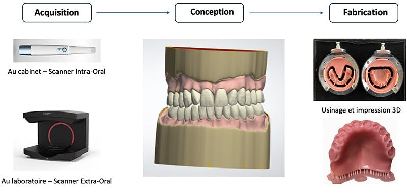 le flux numérique en prothèse amovible complète