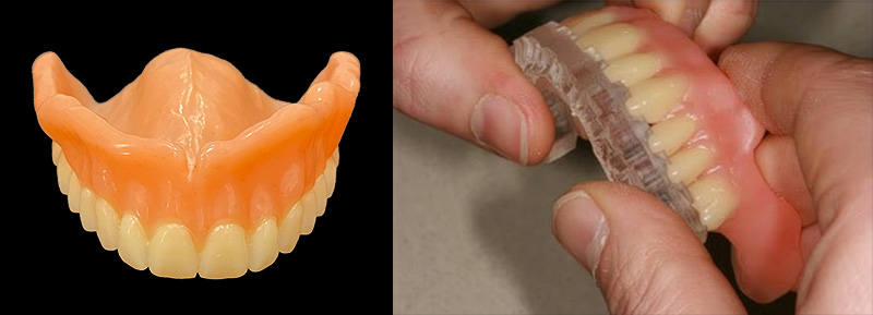 Usinage de la base prothétique