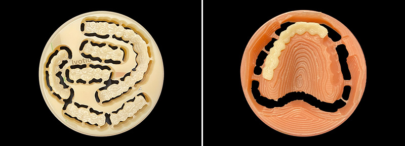 usinage monobloc de la base prothétique et les dents