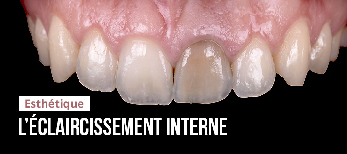 Slider-Article-Charles-TOLEDANO-Eclaircissement-interne