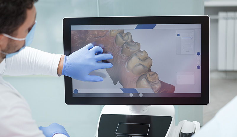 numérique : dentiste examinant l'écran d'ordinateur d'un patient lors d'un scanner dentaire