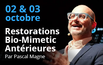 Restorations Bio-Mimetic Antérieures